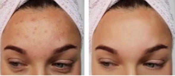 Image 6 10 25 At 1.30 Pm