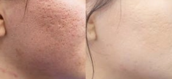 Image 6 10 25 At 2.12 Pm