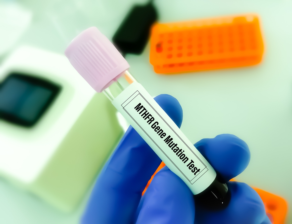 Blood,sample,for,mthfr,variant,or,mthfr,mutation,test.
