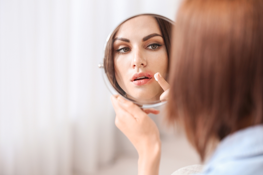 Young,Woman,With,Cold,Sore,Applying,Remedy,At,Home