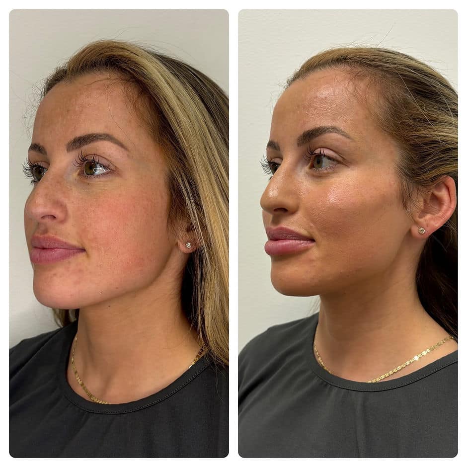 458e0d 3e049b2be1aa455e83ca7c5b68239e3d~mv2