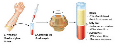 1772580315_458e0d_bbcb5c020f8a4001a71e2cdf145266camv2-1