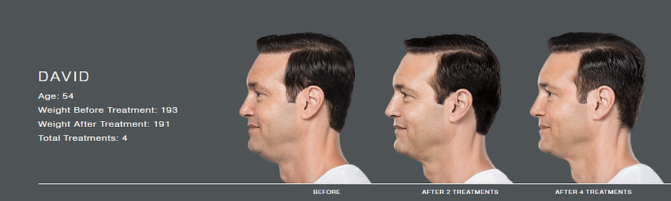 458e0d d8966d6f7f25459a9a5e5c3e6c9a58c7~mv2