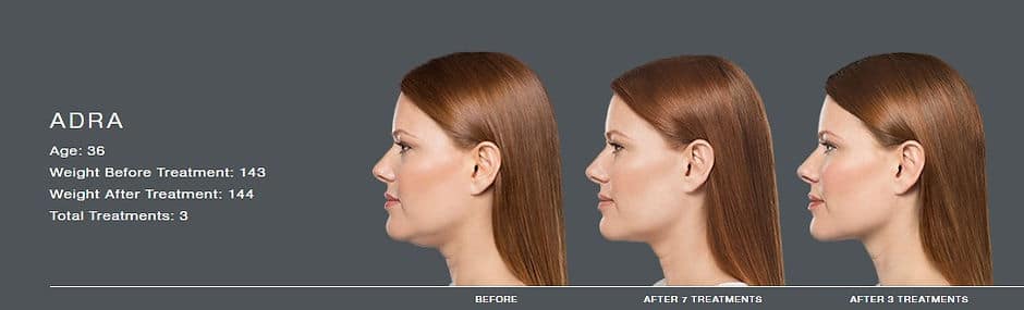 458e0d f4df069613274a939d5f024c2f630129~mv2