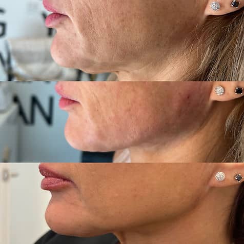 458e0d 6f4f3c4a8b4848bda204724a67832b17~mv2