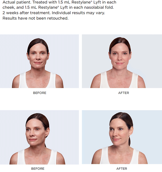 458e0d 2cd1bd26c8c84e7b986c38e25be84140~mv2