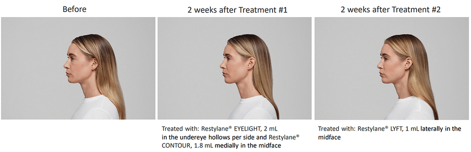 458e0d 9dcb226a965a4b3f8824e10460bf3bd8~mv2