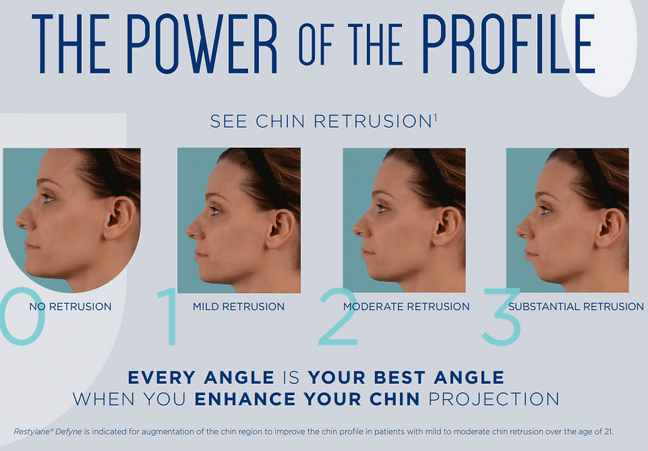 458e0d 887aedb086d64e1cbbb0a2fd91f4ec8a~mv2