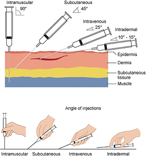 458e0d_50ae4124d0db453fafc4d70d3aaf496amv2 Subcutaneous Injection Instructions & Needle Disposal