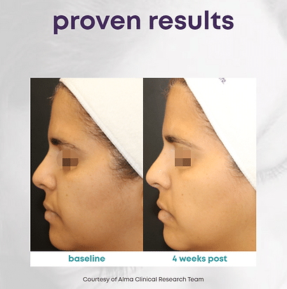 458e0d_7f582b8d2362466c9d24f80c1305feeemv2 LMNT in Sandy, UT