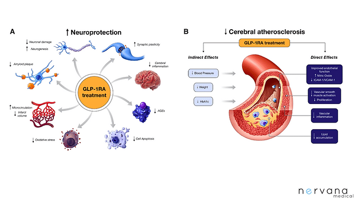 458e0d_80a9ee3d2601443a898ca94d6def4935mv2 Weight Loss Consultation in Sandy, UT