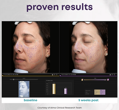 458e0d_a383ce4b180d45ef9720e39636373a69mv2 LMNT in Sandy, UT