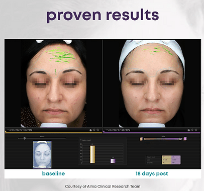 458e0d_b81fc1931a4c4591a9421a815fb85cd0mv2 LMNT in Sandy, UT