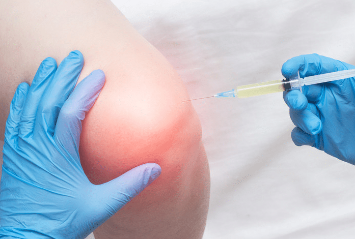 Durolane Knee Injections in Sandy, UT