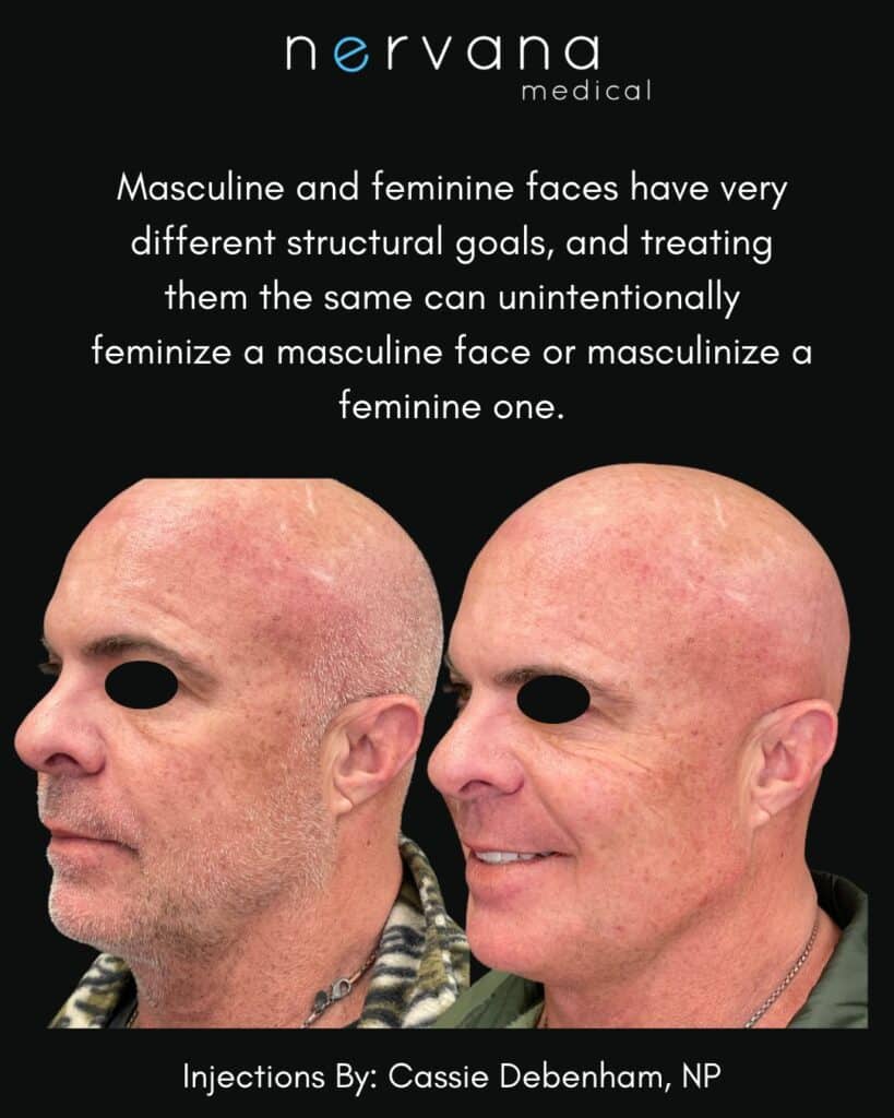 Before and After Image: Masculine Injections - front