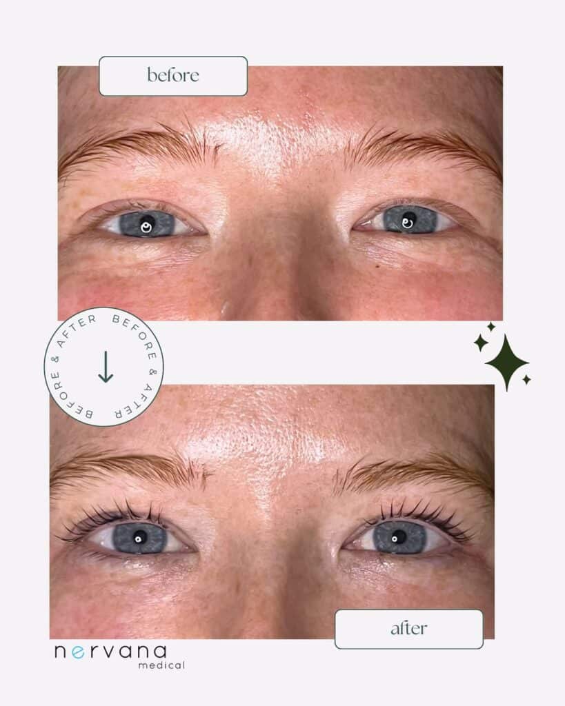 Before and After Image: Lash Lift and Tint - front
