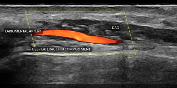 us What Is Facial Balancing? An Anatomy-First Approach in Sandy, UT