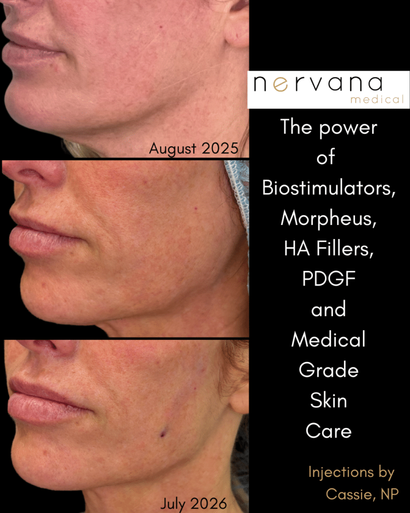 Before and After Image: Multi Modality Treatment Plans - front